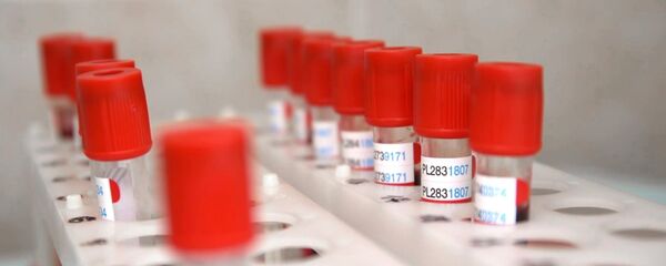 Пробирки с кровью для анализа на covid-19 - Sputnik Тоҷикистон