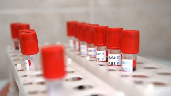Пробирки с кровью для анализа на covid-19 - Sputnik Тоҷикистон