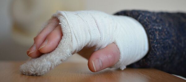 Рука в гипсе - Sputnik Тоҷикистон