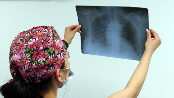 Медик госпиталя смотрит рентгеновский снимок легких пациента - Sputnik Таджикистан
