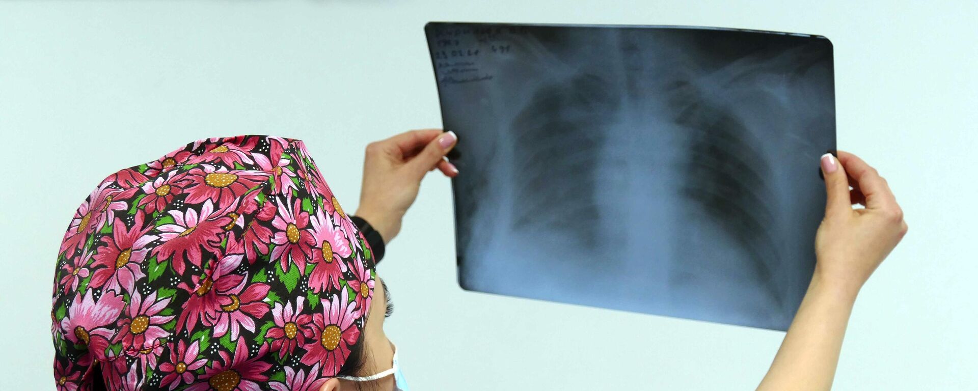 Медик госпиталя смотрит рентгеновский снимок легких пациента - Sputnik Таджикистан, 1920, 09.12.2021