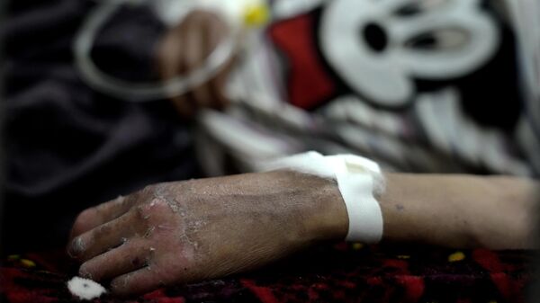 Пациент в госпитале Кабула. Архивное фото - Sputnik Таджикистан
