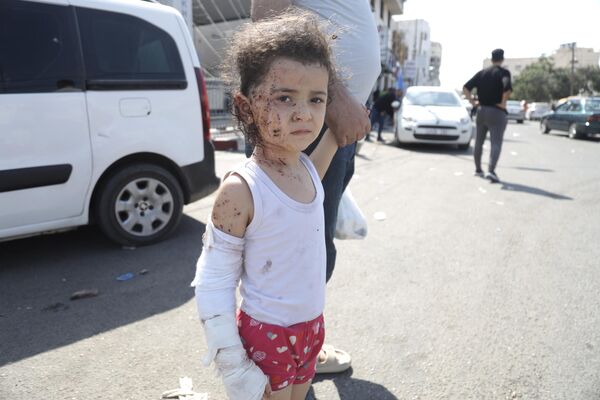 Ребенок, пострадавший в результате ракетных ударов ВС Израиля по Газе - Sputnik Таджикистан