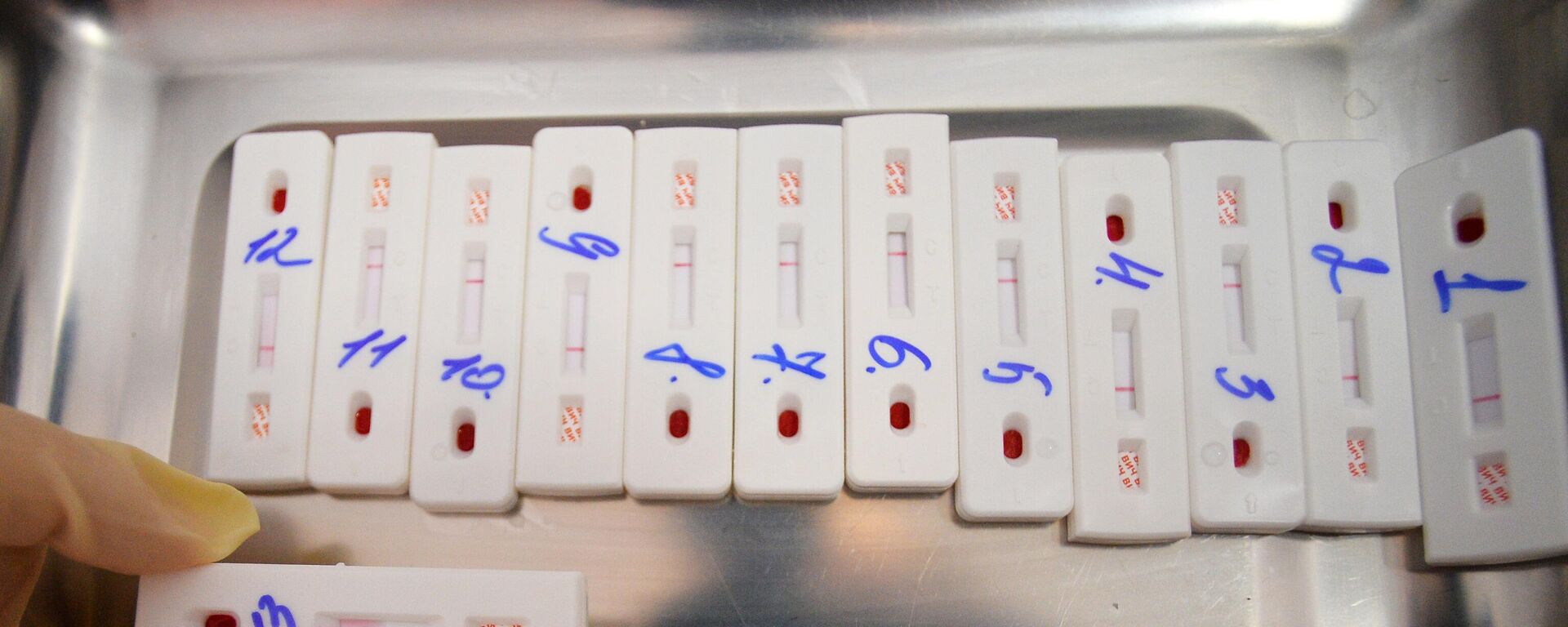 Экспресс-тестирование на ВИЧ. Иллюстративное фото - Sputnik Тоҷикистон, 1920, 26.06.2024