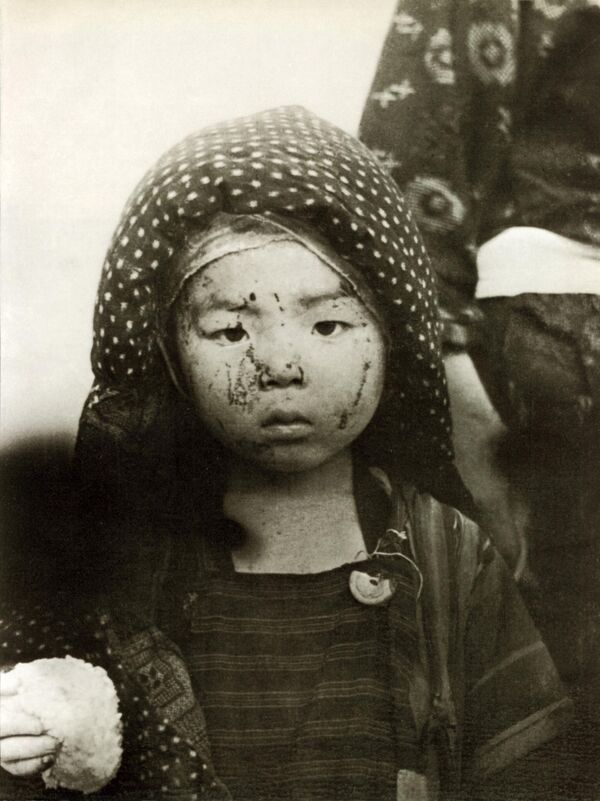 Жертва атомной бомбардировки в Нагасаки в 1945 году. - Sputnik Таджикистан