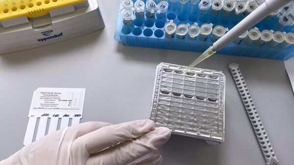 Тест-система для выявления случаев заражения вирусами. Иллюстративное фото - Sputnik Таджикистан