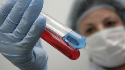 Работа вирусологической лаборатории в Ростове-на-Дону