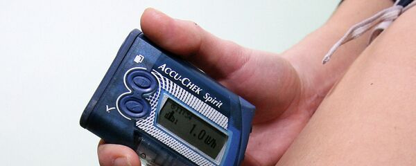 Инсулиновая помпа. Архивное фото - Sputnik Тоҷикистон