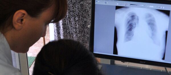 Рентген легких. Архивное фото Рентген легких. Архивное фото - Sputnik Таджикистан