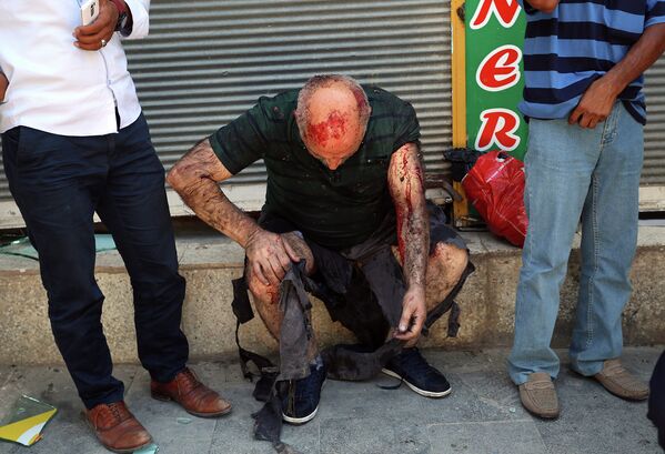 Раненый мужчина ждет медицинскую помощь после теракта в городе Суруч. - Sputnik Таджикистан