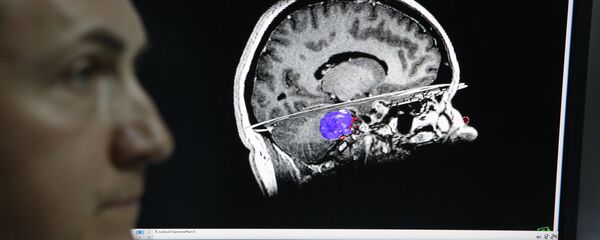 Изображение головного мозга. Архивное фото - Sputnik Таджикистан