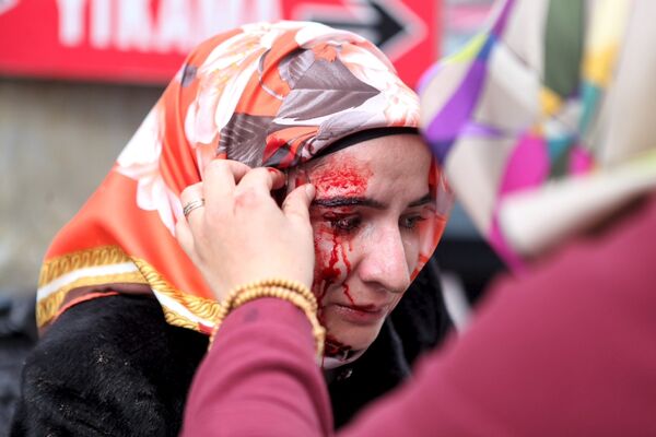 Раненая сторонница газеты Заман получает первую помощь после того, как турецкая полиция разогнала протестующих во время рейда в редакции издания в Стамбуле - Sputnik Таджикистан
