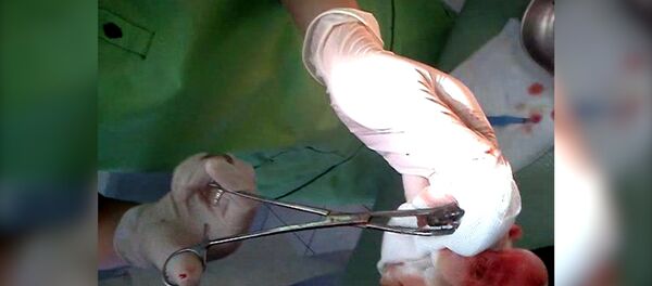 Врачи показали фашистскую пулю, извлеченную  спустя 73 года - Sputnik Тоҷикистон