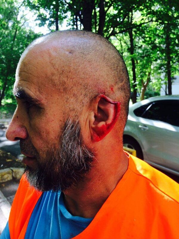 Пострадавший дворник с поврежденным ухом - Sputnik Тоҷикистон