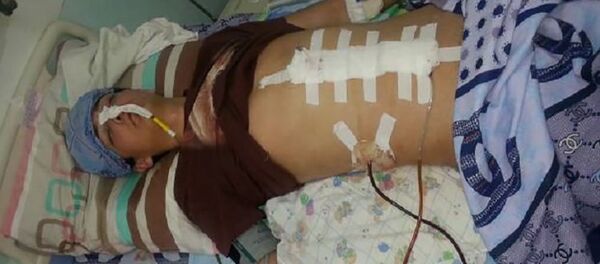 Студент Жасурбек Ибрагимов после очередной операции - Sputnik Таджикистан