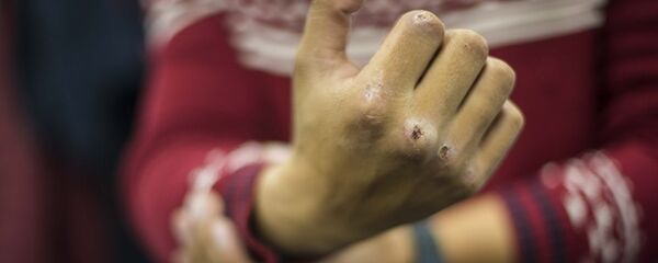 Мужчина показывает разбитый кулак, архивное фото Мужчина показывает разбитый кулак, архивное фото - Sputnik Тоҷикистон