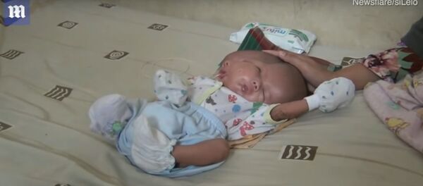 В Индонезии родился ребенок с двумя лицами - Sputnik Таджикистан