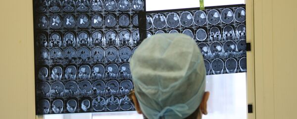 Врач смотрит на рентген-снимки мозга. Архивное фото Врач смотрит на рентген-снимки мозга. Архивное фото - Sputnik Таджикистан