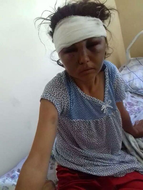 Не оставил живого места: жених избил невесту сразу после свадьбы - фото - Sputnik Таджикистан