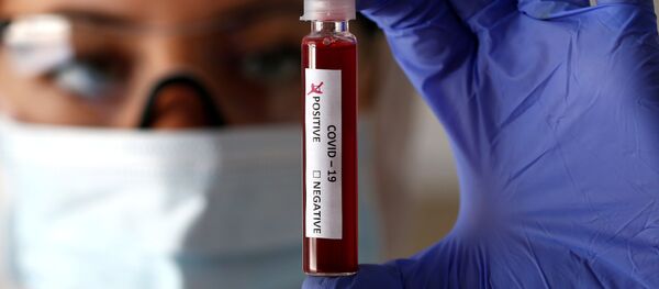 Пробирка с коронавирусом 2019-nCoV - Sputnik Тоҷикистон