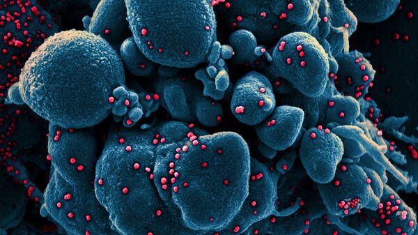 Вид на зараженную коронавирусом клетку под микроскопом - Sputnik Тоҷикистон