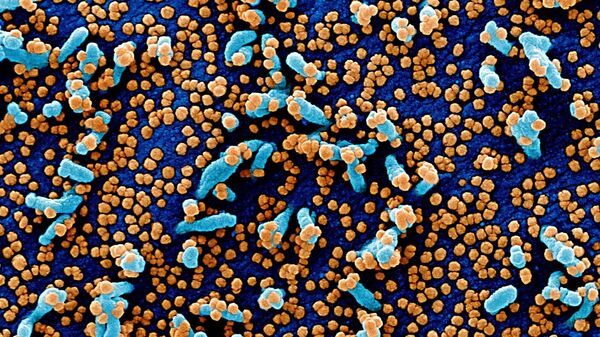 Вид на зараженную коронавирусом клетку под микроскопом - Sputnik Тоҷикистон
