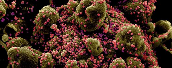 Вид на зараженную коронавирусом клетку под микроскопом - Sputnik Таджикистан