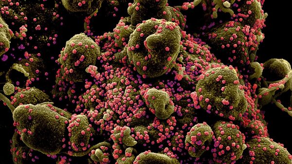 Вид на зараженную коронавирусом клетку под микроскопом - Sputnik Таджикистан