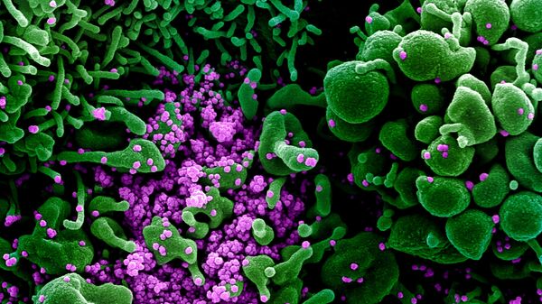 Микрофотография частиц коронавируса в клетке зараженного человека - Sputnik Тоҷикистон