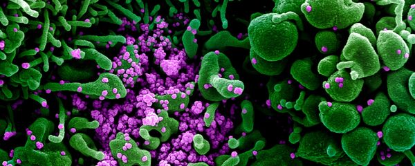 Микрофотография частиц коронавируса в клетке зараженного человека - Sputnik Тоҷикистон