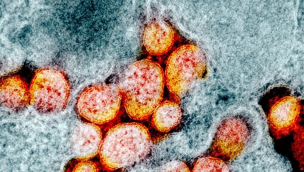 Микрофотография частиц коронавируса в клетке зараженного человека - Sputnik Тоҷикистон