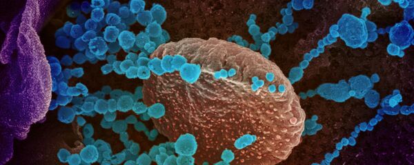 Вид на зараженную коронавирусом  клетку под микроскопом  - Sputnik Таджикистан