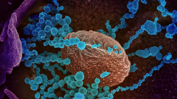 Вид на зараженную коронавирусом  клетку под микроскопом  - Sputnik Таджикистан