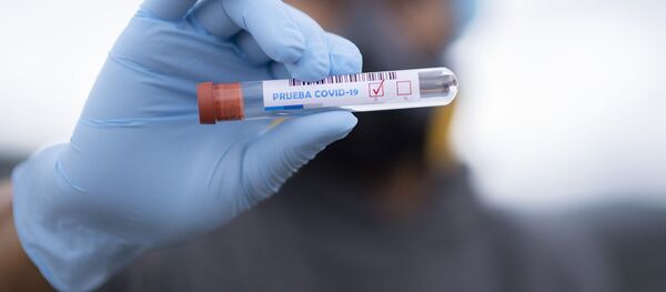 Пробирка с тестом на коронавирус в руках Пробирка с тестом на коронавирус в руках - Sputnik Тоҷикистон