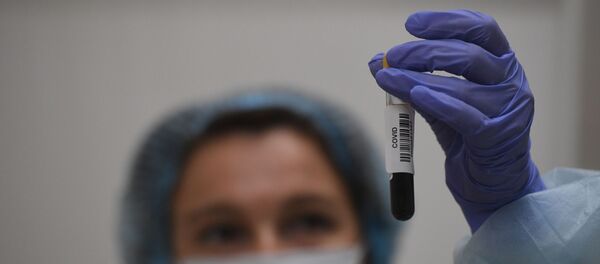 Пробирка с кровью анализа на антитела к коронавирусу COVID-19 Пробирка с кровью анализа на антитела к коронавирусу COVID-19 - Sputnik Тоҷикистон